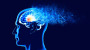 Alzheimer-Studie enthüllt Erfolge durch Schallwellen-Therapie | Leben & Wissen | BILD.de